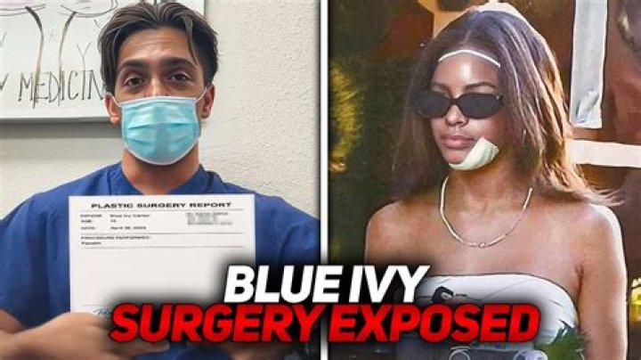 Blue Ivy Plastic Surgery Controversy Explained The Latest Buzz