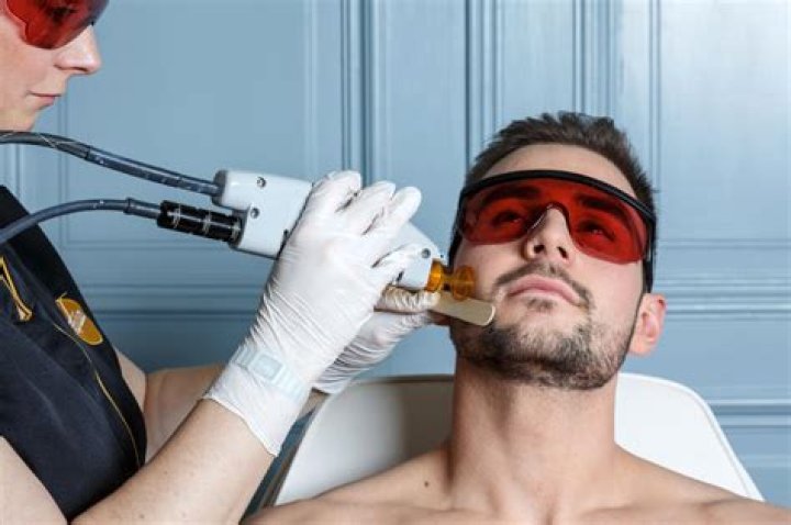 Facial Hair Removal: The Ultimate Guide to Smoother Skin