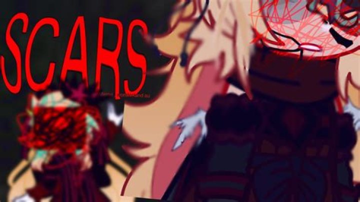 Scars Wonderland Leak XXX: Your Guide to Preventing and Treating Scars