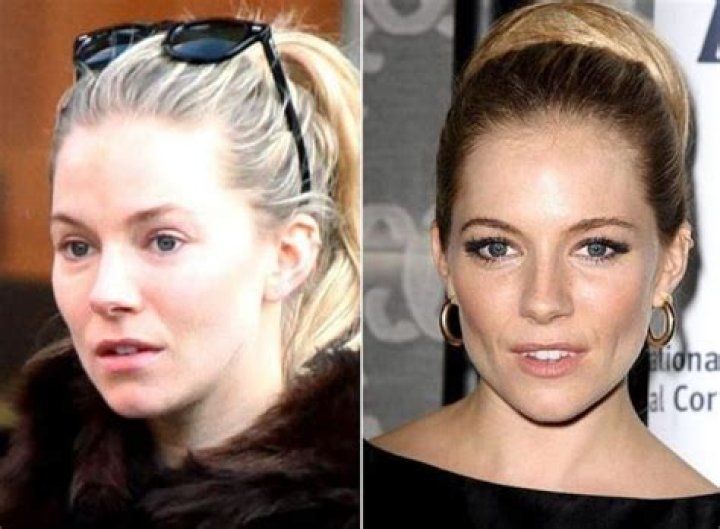 Sienna Miller Plastic Surgery: Exploring Her Beauty Evolution