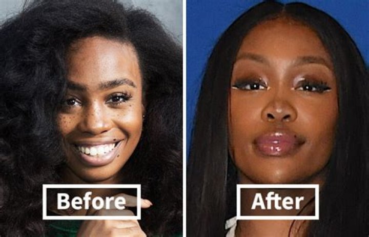 SZA Before Plastic Surgery: A Look Back at Her Early Days